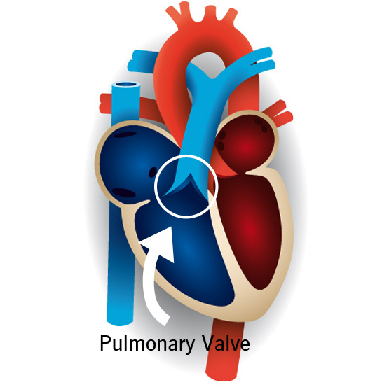 Normal Heart