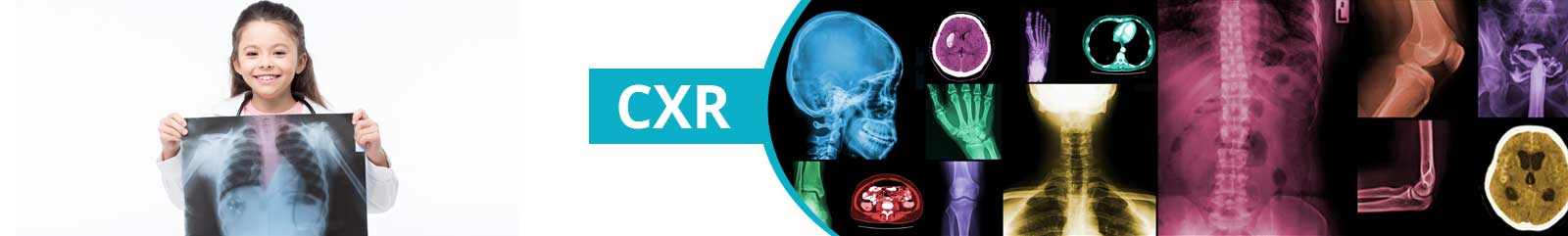Chest X-ray